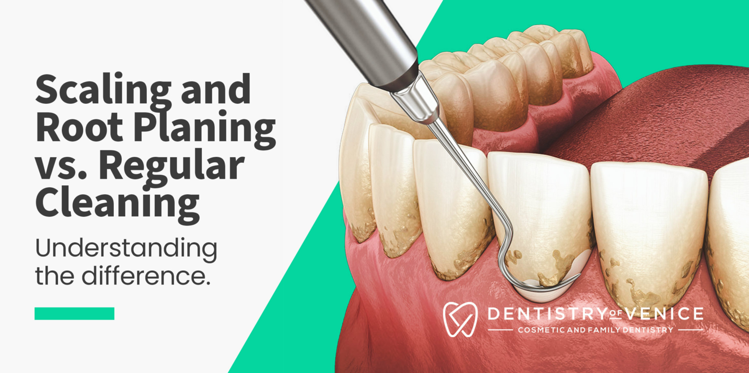 Scaling and Root Planing vs. Regular Cleaning