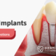 Dental Implants Benefits